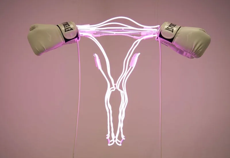 Zoe Buckman's "Champ" is on view in the 21c Museum Hotel exhibition "The Future is Female."