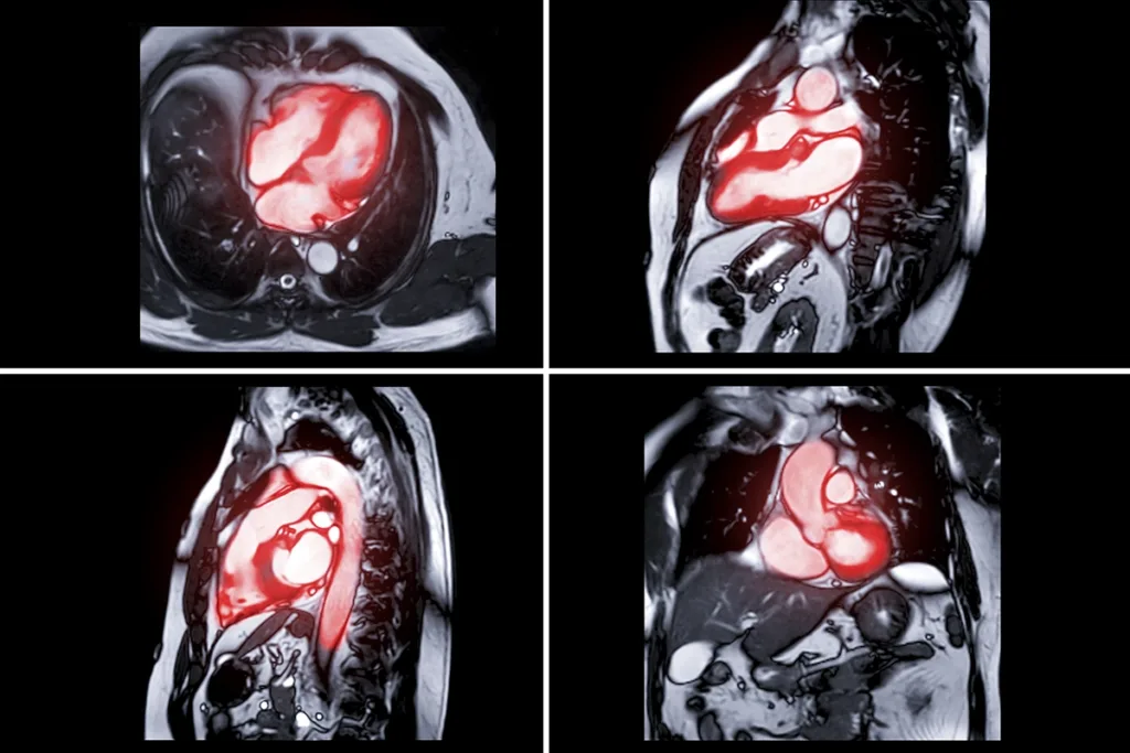 Cardiac Imaging