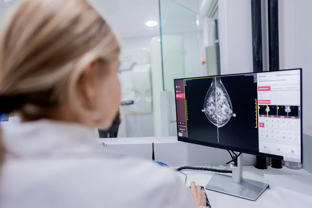 Mammogram