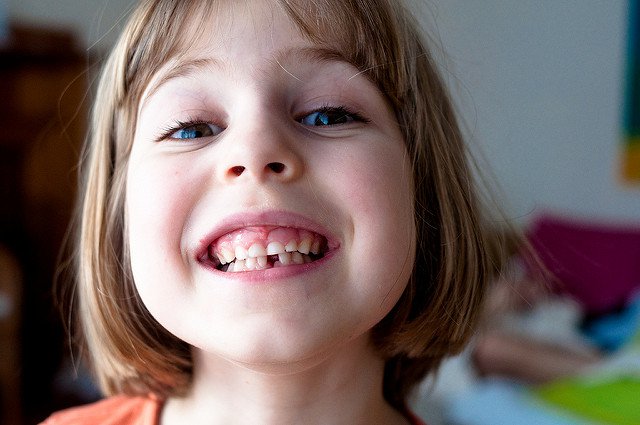 Tooth Fairy Fees & Fiascos: When Losing a Tooth Goes All Wrong