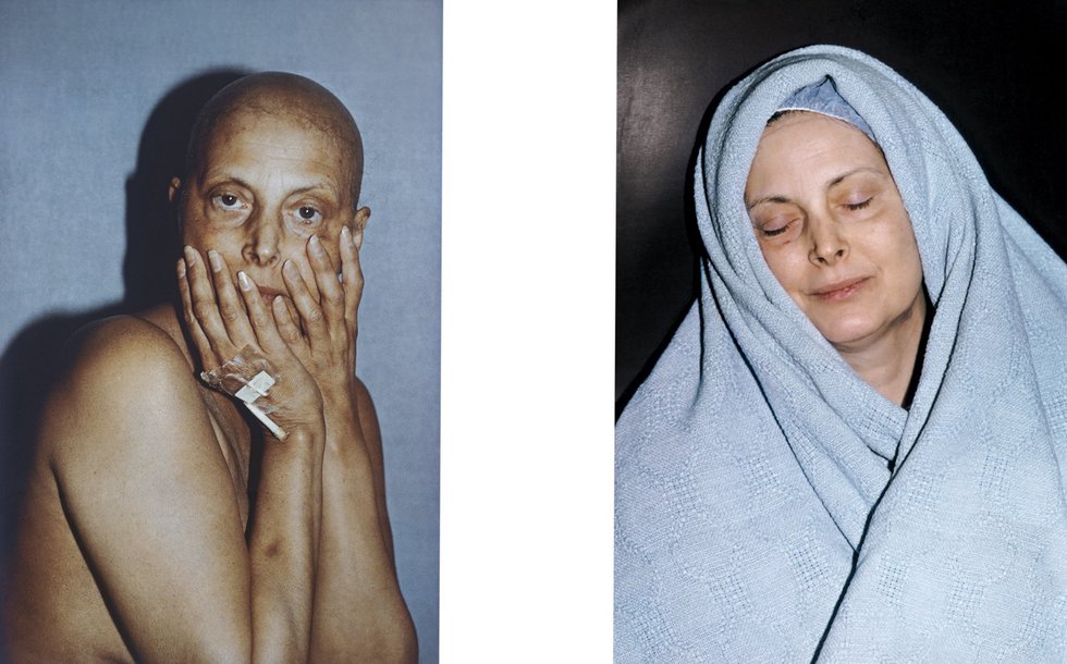 See this now: 'Hannah Wilke: Art for Life's Sake' at the Pulitzer